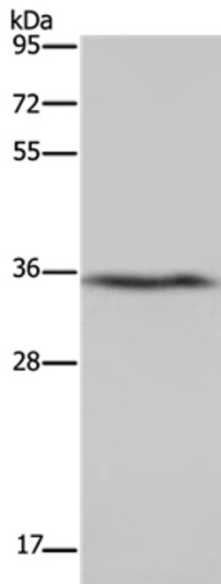 Invitrogen DDAH1 Polyclonal Antibody 100 &mu;L; Unconjugated:Antibodies,