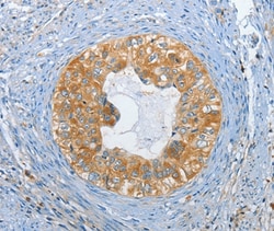 DGKZ Polyclonal Antibody:Antibodies, Polyclonal