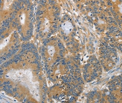 DGKZ Polyclonal Antibody:Antibodies, Polyclonal
