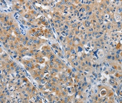 Invitrogen NEK1 Polyclonal Antibody 100 &mu;L; Unconjugated:Antibodies,