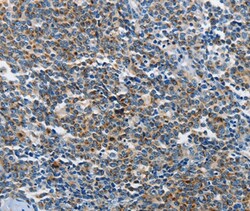 Invitrogen NEK1 Polyclonal Antibody 100 &mu;L; Unconjugated:Antibodies,