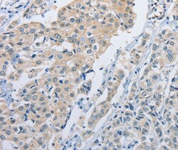 Invitrogen NEK9 Polyclonal Antibody 100 &mu;L; Unconjugated:Antibodies,