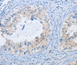 Invitrogen NEK9 Polyclonal Antibody 100 &mu;L; Unconjugated:Antibodies,