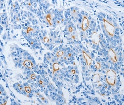 Invitrogen NEK10 Polyclonal Antibody 100 &mu;L; Unconjugated:Antibodies,