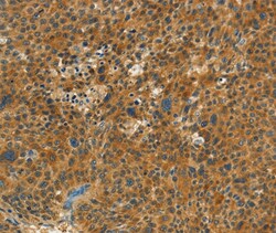 Invitrogen C15orf2 Polyclonal Antibody 100 &mu;L; Unconjugated:Antibodies,