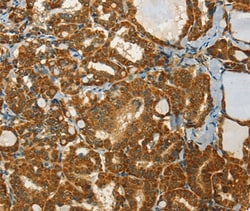 Invitrogen C15orf2 Polyclonal Antibody 100 &mu;L; Unconjugated:Antibodies,