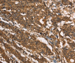 Invitrogen MOSC1 Polyclonal Antibody 100 &mu;L; Unconjugated:Antibodies,