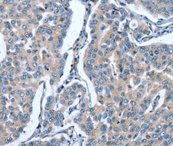 Invitrogen GINS1 Polyclonal Antibody 100 &mu;L; Unconjugated:Antibodies,