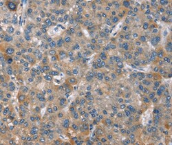 Invitrogen GINS1 Polyclonal Antibody 100 &mu;L; Unconjugated:Antibodies,
