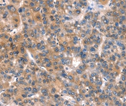 Invitrogen CaV2.1 Polyclonal Antibody 100 &mu;L; Unconjugated:Antibodies,
