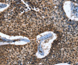 CACNB2 Polyclonal Antibody:Antibodies, Polyclonal
