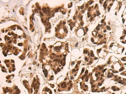 Invitrogen CAMTA1 Polyclonal Antibody 100 &mu;L; Unconjugated:Antibodies,
