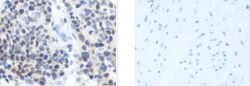 Invitrogen CAMTA1 Polyclonal Antibody 100 &mu;L; Unconjugated:Antibodies,