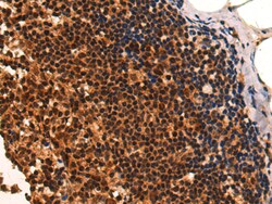 Invitrogen CAMTA1 Polyclonal Antibody 100 &mu;L; Unconjugated:Antibodies,