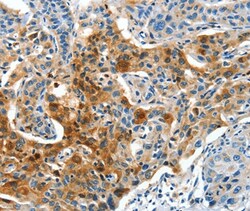 Invitrogen COG1 Polyclonal Antibody 100 &mu;L; Unconjugated:Antibodies,