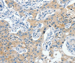 CNTNAP3 Polyclonal Antibody:Antibodies, Polyclonal