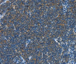 CNTNAP3 Polyclonal Antibody:Antibodies, Polyclonal