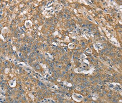 Invitrogen CSMD1 Polyclonal Antibody 100 &mu;L; Unconjugated:Antibodies,