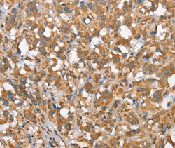 Invitrogen CSMD1 Polyclonal Antibody 100 &mu;L; Unconjugated:Antibodies,