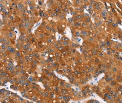 Invitrogen MT-CYB Polyclonal Antibody 100 &mu;L; Unconjugated:Antibodies,