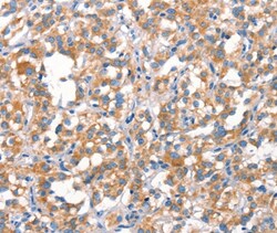 Invitrogen MT-CYB Polyclonal Antibody 100 &mu;L; Unconjugated:Antibodies,