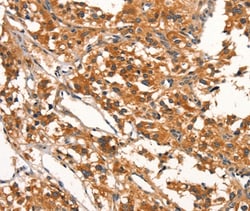 Invitrogen DDAH2 Polyclonal Antibody 100 &mu;L; Unconjugated:Antibodies,