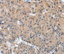Invitrogen DSC1 Polyclonal Antibody 100 &mu;L; Unconjugated:Antibodies,
