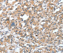 Invitrogen DSC1 Polyclonal Antibody 100 &mu;L; Unconjugated:Antibodies,