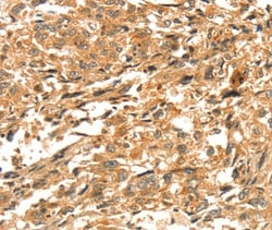 Invitrogen DIRAS1 Polyclonal Antibody 100 &mu;L; Unconjugated:Antibodies,
