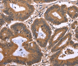 Invitrogen EAP2 Polyclonal Antibody 100 &mu;L; Unconjugated:Antibodies,