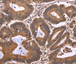 EAP2 Polyclonal Antibody, Invitrogen 100 &mu;L; Unconjugated:Antibodies,