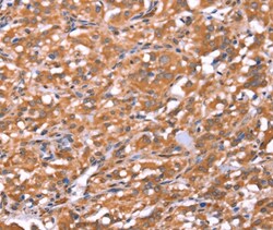 Invitrogen FAM13B Polyclonal Antibody 100 &mu;L; Unconjugated:Antibodies,