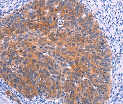 PTPN13 Polyclonal Antibody:Antibodies, Polyclonal