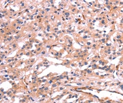 PTPN13 Polyclonal Antibody:Antibodies, Polyclonal