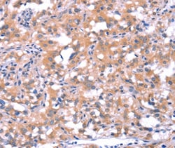 Invitrogen FAT1 Polyclonal Antibody 100 &mu;L | Buy Online | Invitrogen&trade; | Fisher Scientific