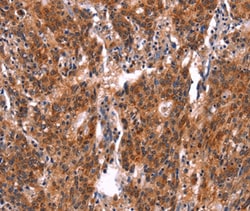 Invitrogen FEM1A Polyclonal Antibody 100 &mu;L; Unconjugated:Antibodies,