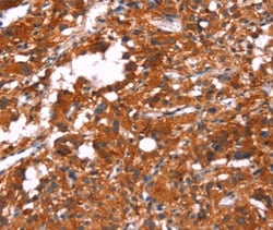 Invitrogen FEM1A Polyclonal Antibody 100 &mu;L; Unconjugated:Antibodies,
