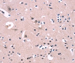Invitrogen FGF16 Polyclonal Antibody 100 &mu;L; Unconjugated:Antibodies,