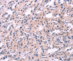 Invitrogen FGF16 Polyclonal Antibody 100 &mu;L; Unconjugated:Antibodies,