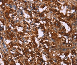 Invitrogen GAGE12I Polyclonal Antibody 100 &mu;L; Unconjugated:Antibodies,