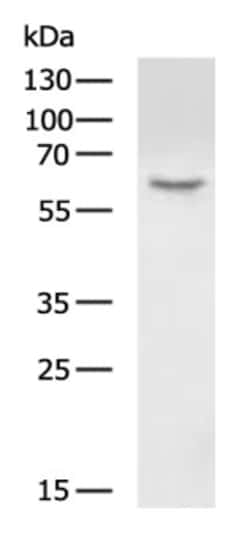 Invitrogen HAS1 Polyclonal Antibody 100 &mu;L; Unconjugated:Antibodies,