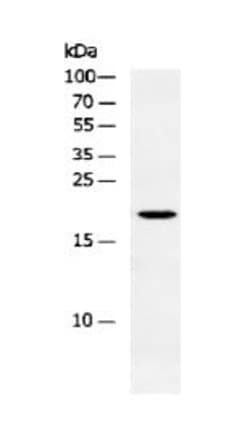 Invitrogen HES5 Polyclonal Antibody 100 &mu;L | Buy Online | Invitrogen&trade; | Fisher Scientific