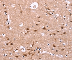 Invitrogen HIPK1 Polyclonal Antibody 100 &mu;L; Unconjugated:Antibodies,
