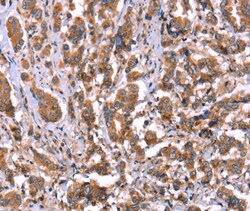 HRG Polyclonal Antibody:Antibodies, Polyclonal