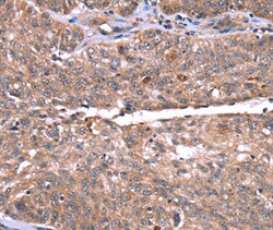HRG Polyclonal Antibody:Antibodies, Polyclonal