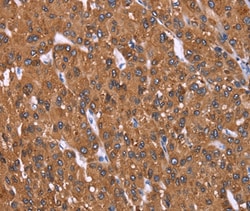 Invitrogen HRASLS2 Polyclonal Antibody 100 &mu;L; Unconjugated:Antibodies,