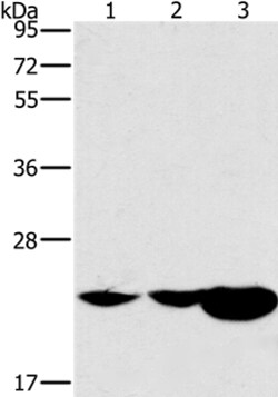 Invitrogen HRASLS2 Polyclonal Antibody 100 &mu;L; Unconjugated:Antibodies,