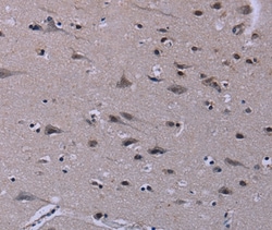 ID3 Polyclonal Antibody:Antibodies, Polyclonal