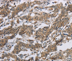 Invitrogen Synapsin 2 Polyclonal Antibody 100 &mu;L; Unconjugated:Antibodies,