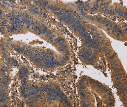 Invitrogen KCNG1 Polyclonal Antibody 100 &mu;L; Unconjugated:Antibodies,